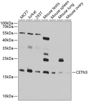 Centrin 3 Antibody in Western Blot (WB)