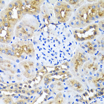 Ninein Antibody in Immunohistochemistry (Paraffin) (IHC (P))