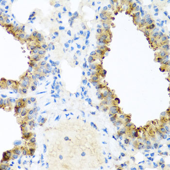 Ninein Antibody in Immunohistochemistry (Paraffin) (IHC (P))