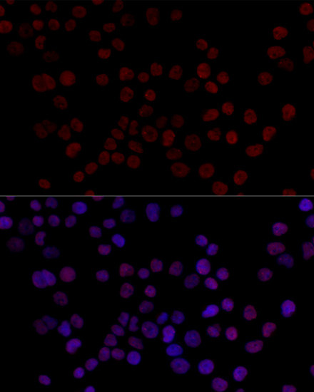 hnRNP L Antibody in Immunocytochemistry (ICC/IF)