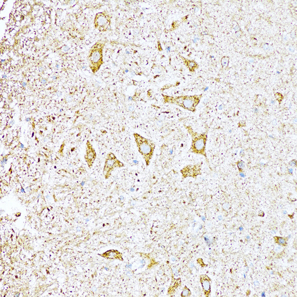 UVRAG Antibody in Immunohistochemistry (Paraffin) (IHC (P))