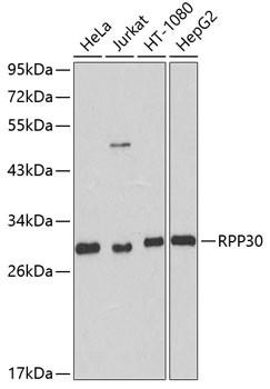 RPP30 Antibody in Western Blot (WB)