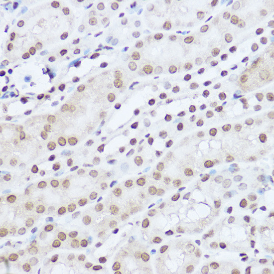SART1 Antibody in Immunohistochemistry (Paraffin) (IHC (P))