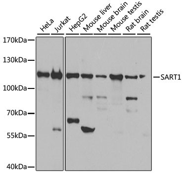 SART1 Antibody in Western Blot (WB)
