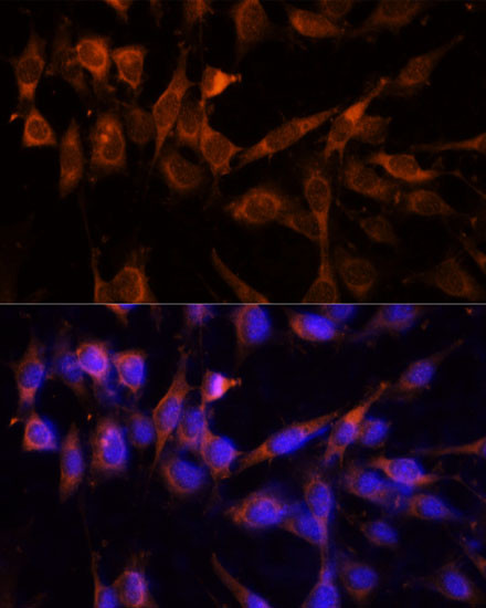 14-3-3 eta Antibody in Immunocytochemistry (ICC/IF)