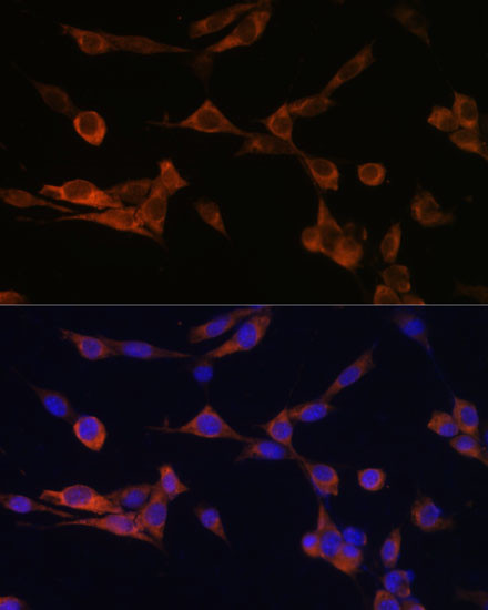 14-3-3 eta Antibody in Immunocytochemistry (ICC/IF)