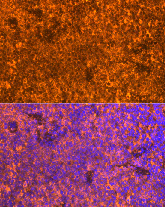 FAM65B Antibody in Immunohistochemistry (Paraffin) (IHC (P))