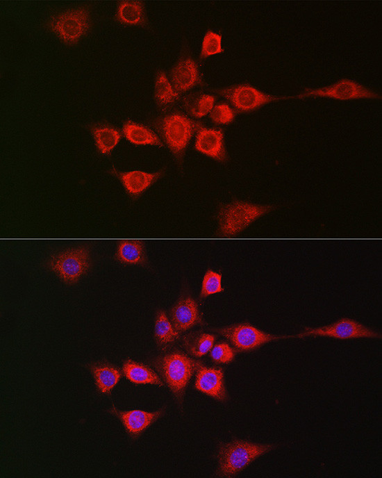 METTL4 Antibody in Immunocytochemistry (ICC/IF)