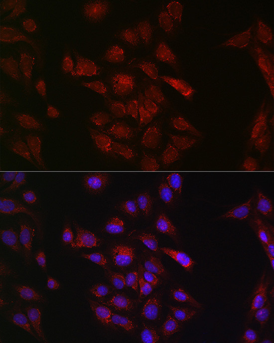 METTL4 Antibody in Immunocytochemistry (ICC/IF)