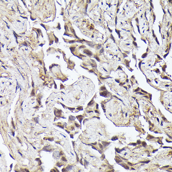 METTL4 Antibody in Immunohistochemistry (Paraffin) (IHC (P))