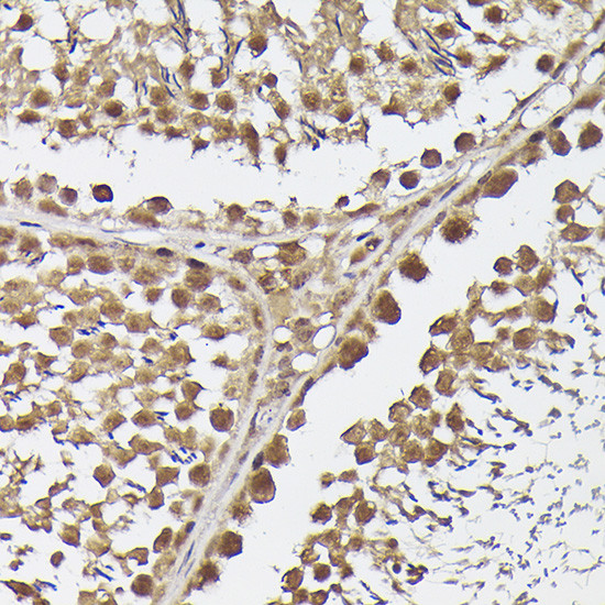 METTL4 Antibody in Immunohistochemistry (Paraffin) (IHC (P))