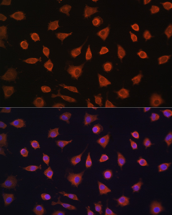 PFKFB2 Antibody in Immunocytochemistry (ICC/IF)