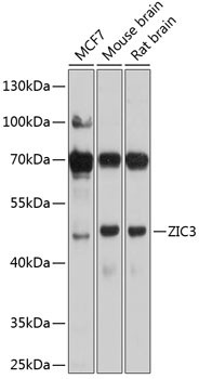 ZIC3 Antibody in Western Blot (WB)
