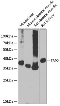 FBP2 Antibody in Western Blot (WB)