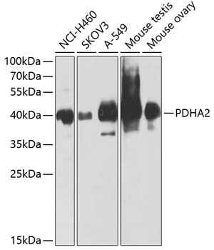 PDHA2 Antibody in Western Blot (WB)