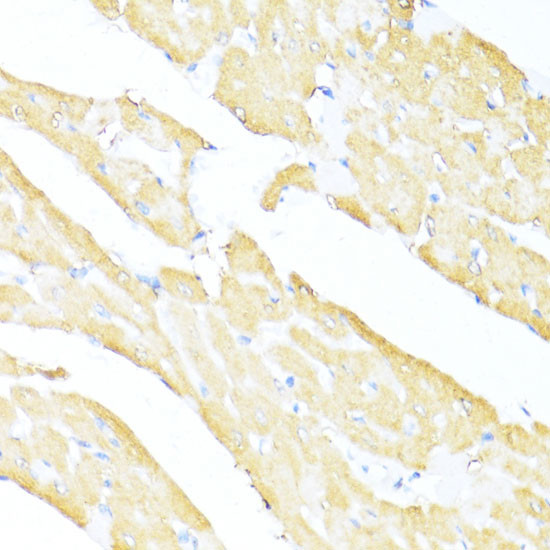 MNF1 Antibody in Immunohistochemistry (Paraffin) (IHC (P))