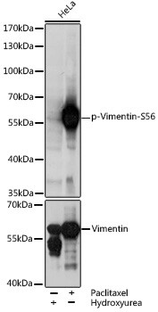 Phospho-Vimentin (Ser56) Antibody in Western Blot (WB)