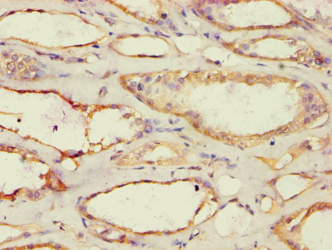 ACAT1 Antibody in Immunohistochemistry (Paraffin) (IHC (P))