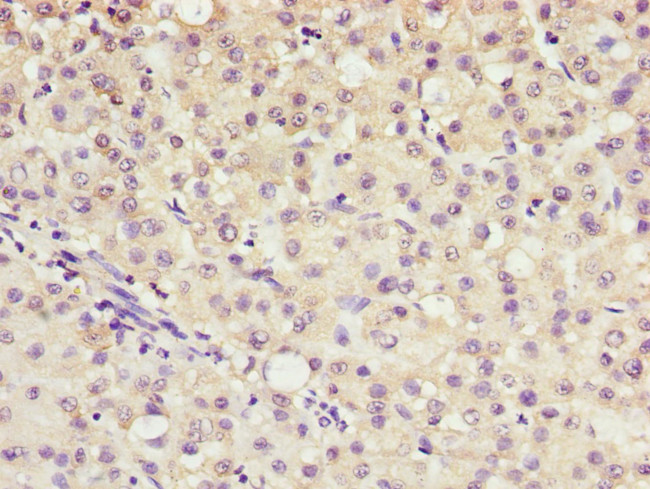 AKR7A2 Antibody in Immunohistochemistry (Paraffin) (IHC (P))