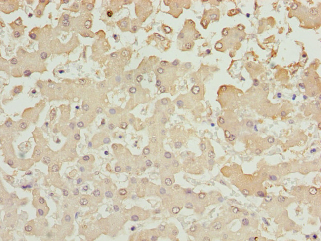 AKR7A2 Antibody in Immunohistochemistry (Paraffin) (IHC (P))