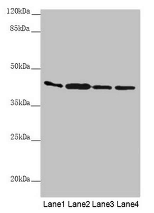 AKR7A2 Antibody in Western Blot (WB)