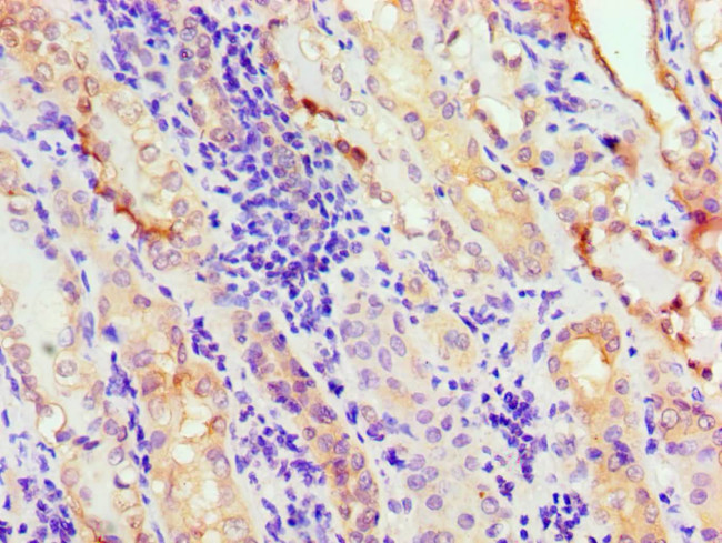 Annexin A11 Antibody in Immunohistochemistry (Paraffin) (IHC (P))