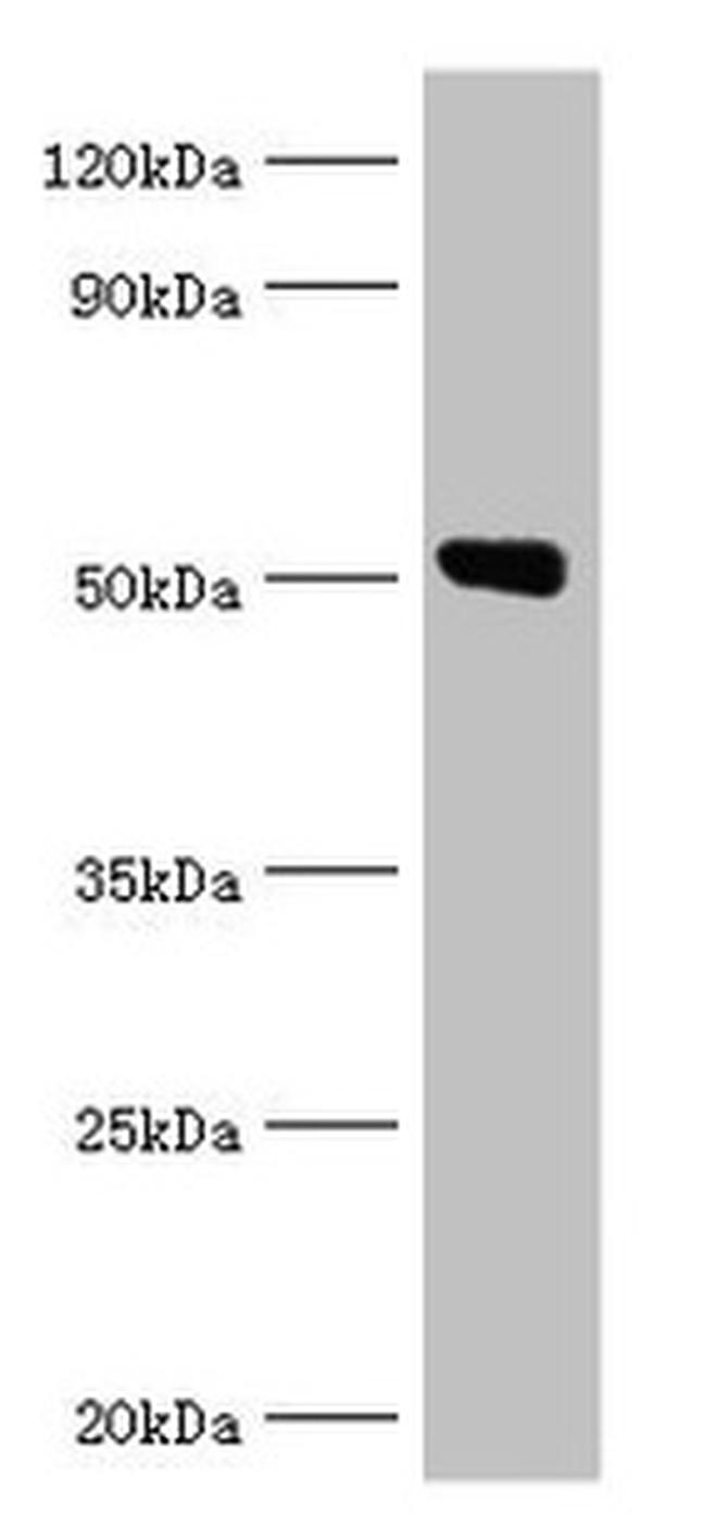 Annexin A11 Antibody in Western Blot (WB)