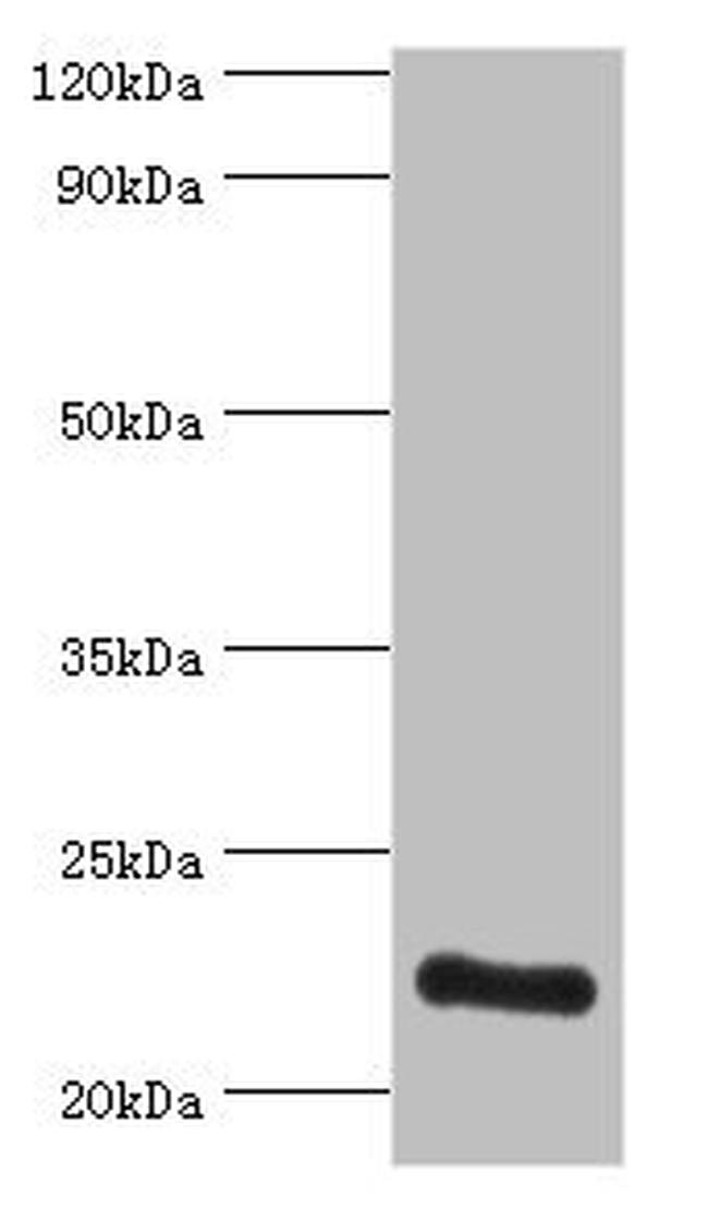 ATP Synthase O Antibody in Western Blot (WB)