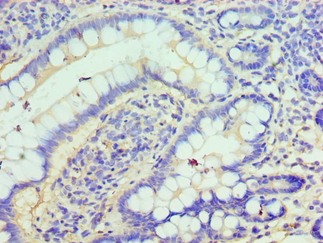 CLIC1 Antibody in Immunohistochemistry (Paraffin) (IHC (P))