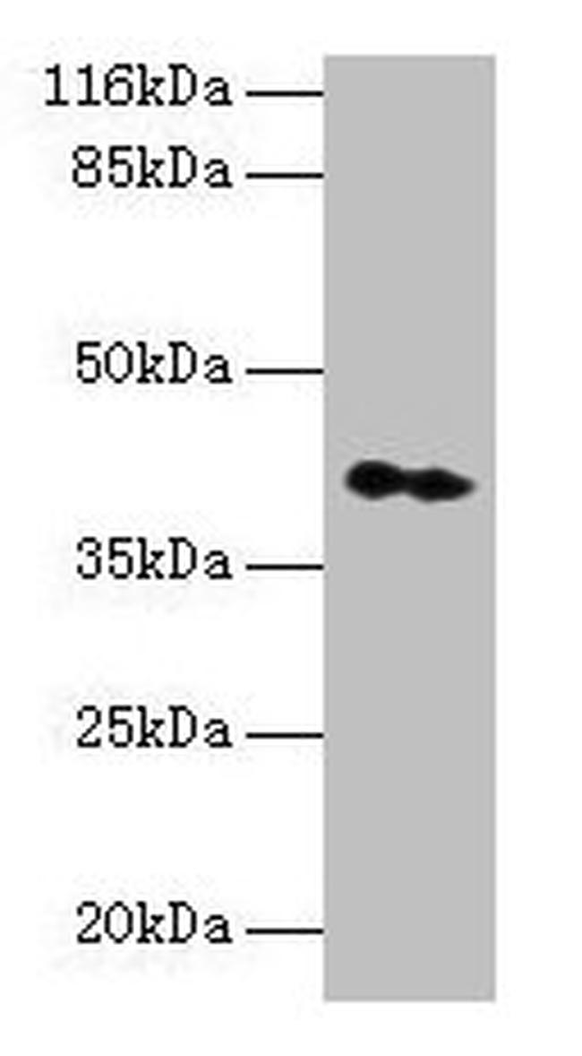 CNTFR Antibody in Western Blot (WB)