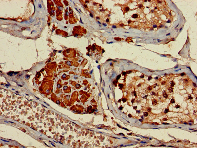 CYP17A1 Antibody in Immunohistochemistry (Paraffin) (IHC (P))