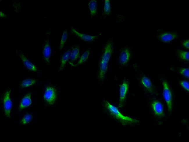 EMP3 Antibody in Immunocytochemistry (ICC/IF)