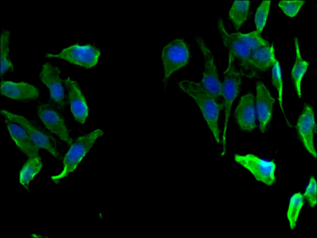 FAH Antibody in Immunocytochemistry (ICC/IF)