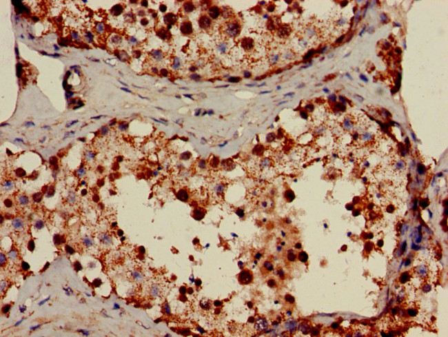 FDXR Antibody in Immunohistochemistry (Paraffin) (IHC (P))