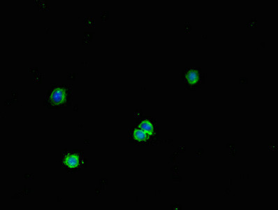 FNTB Antibody in Immunocytochemistry (ICC/IF)