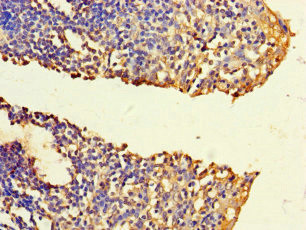 FNTB Antibody in Immunohistochemistry (Paraffin) (IHC (P))