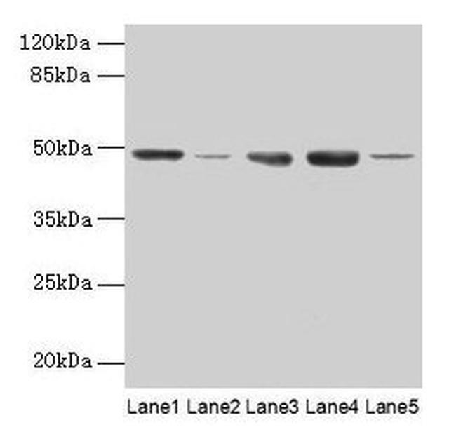 FNTB Antibody in Western Blot (WB)