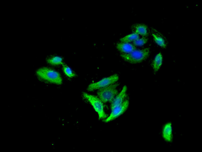 GABRB3 Antibody in Immunocytochemistry (ICC/IF)