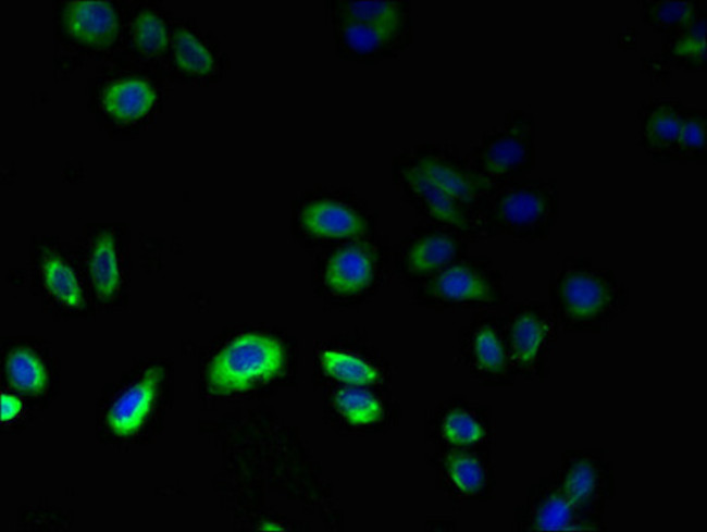 GPR75 Antibody in Immunocytochemistry (ICC/IF)