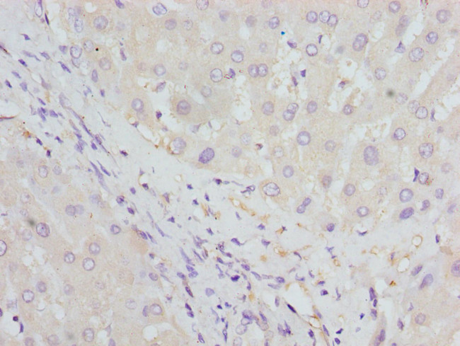 HBZ Antibody in Immunohistochemistry (Paraffin) (IHC (P))