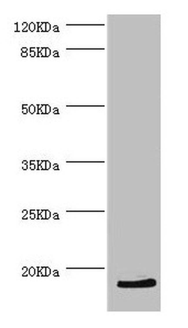 HBZ Antibody in Western Blot (WB)