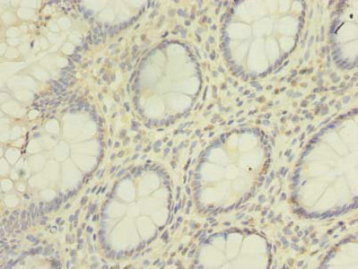 hnRNP L Antibody in Immunohistochemistry (Paraffin) (IHC (P))