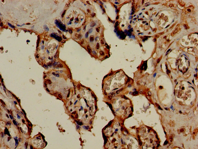 HSD3B1 Antibody in Immunohistochemistry (Paraffin) (IHC (P))