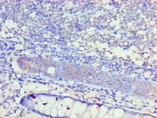 KCNN4 Antibody in Immunohistochemistry (Paraffin) (IHC (P))