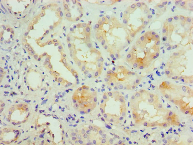 KCNN4 Antibody in Immunohistochemistry (Paraffin) (IHC (P))