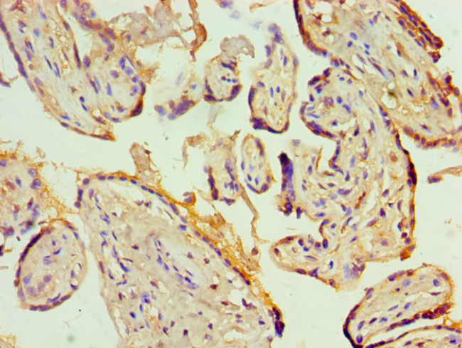 KCNN4 Antibody in Immunohistochemistry (Paraffin) (IHC (P))