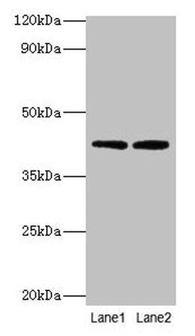 LIAS Antibody in Western Blot (WB)