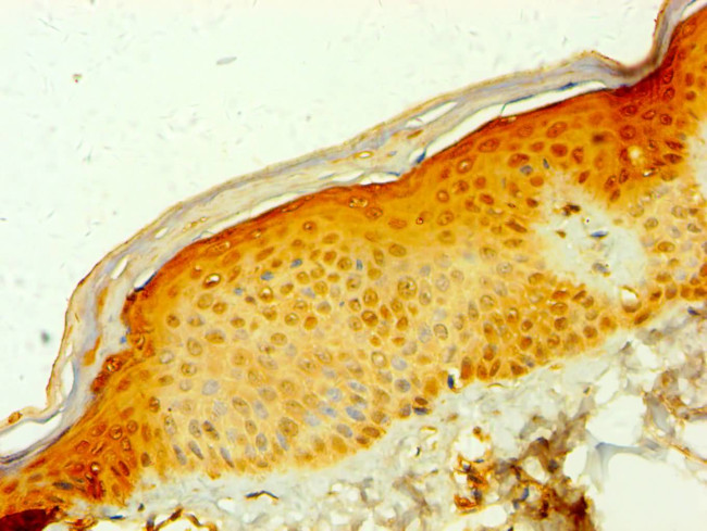 MDH1 Antibody in Immunohistochemistry (Paraffin) (IHC (P))