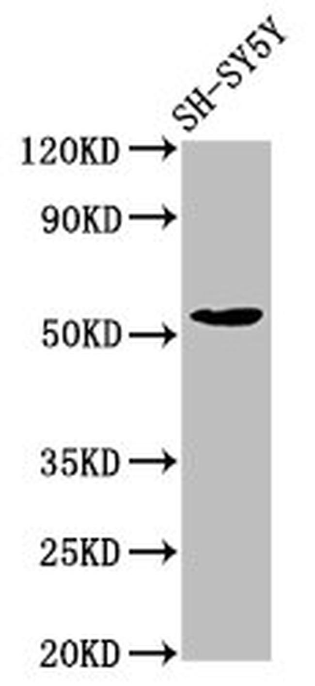 MZF1 Antibody in Western Blot (WB)