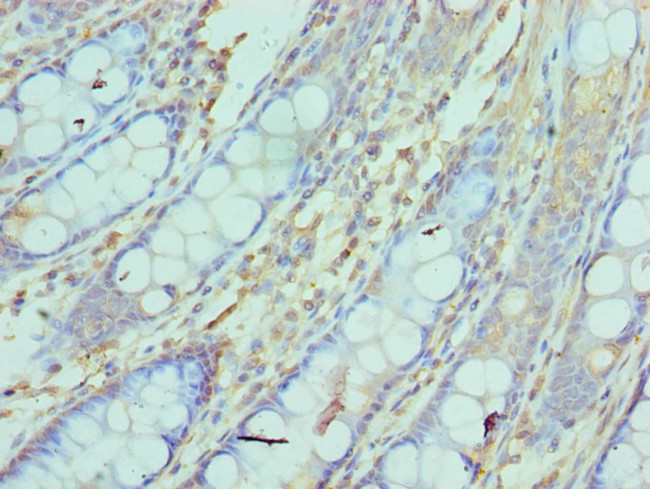 NCBP2 Antibody in Immunohistochemistry (Paraffin) (IHC (P))